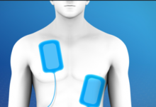 Treating Abnormal Heart Electrical Problems