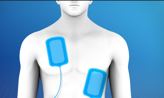 Treating Abnormal Heart Electrical Problems