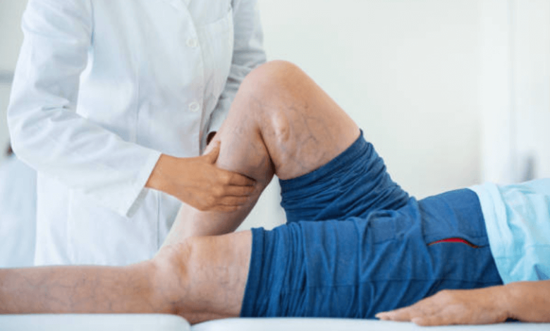 Vein Health Tips to Boost Circulation Naturally