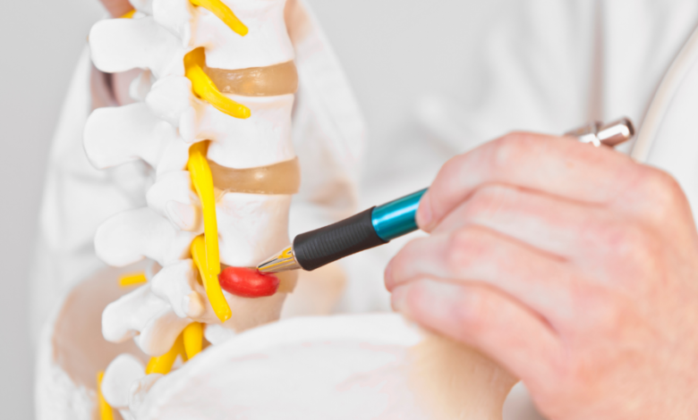 The Differences Between Disc Surgery and Other Spine Treatments