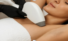 Laser hair removal: Benefits, preparation, and aftercare for lasting comfort