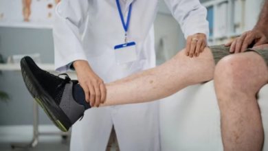 The Benefits of Compression Therapy for Spider Veins