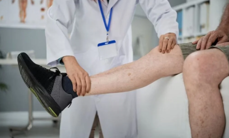 The Benefits of Compression Therapy for Spider Veins